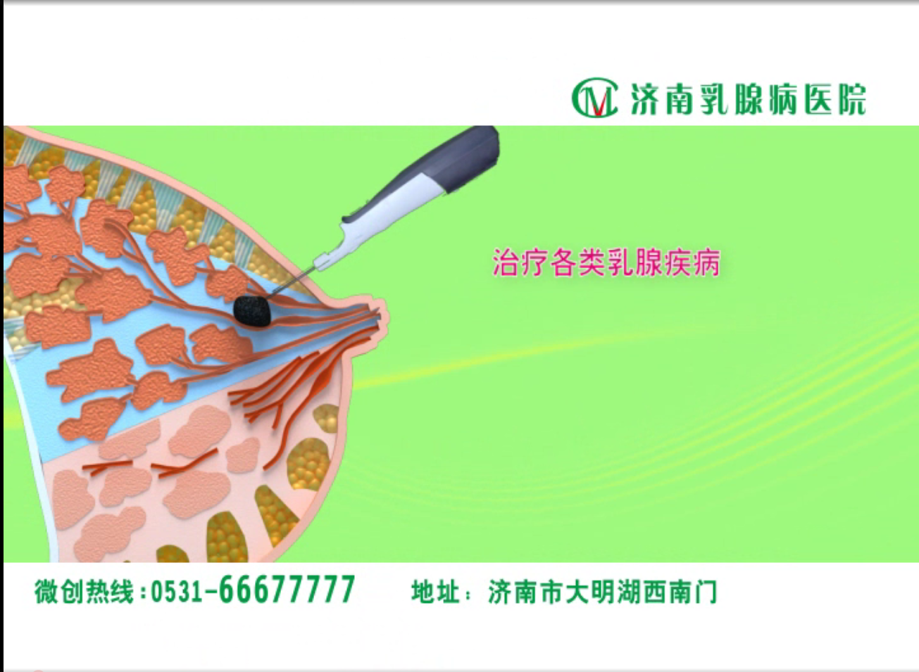 动画视频是提高患者参与度的好方法